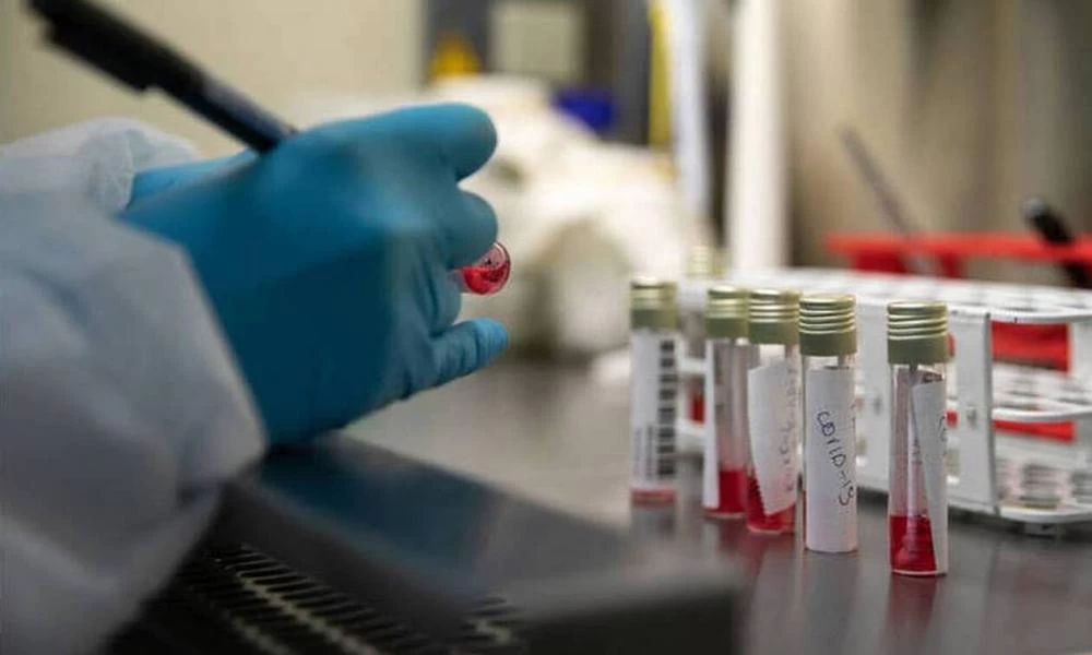 Ινστιτούτο Παστέρ: Θεραπείες κορονοϊού μέχρι το Φθινόπωρο - Θα χτιστεί μια σχετική ανοσία